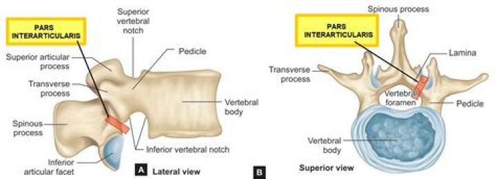 Which portion of the Scottie dog represents the Pars Interarticularis?