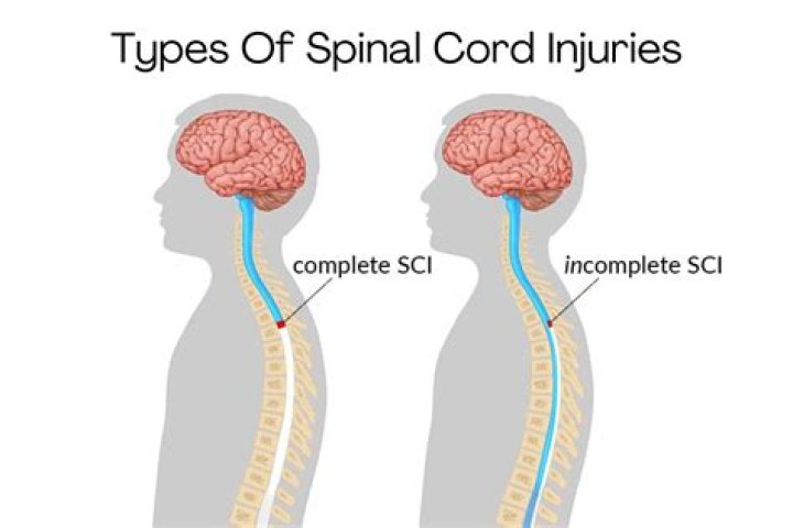 Which type of diagnostic tool is most effective at diagnosing spinal injuries?