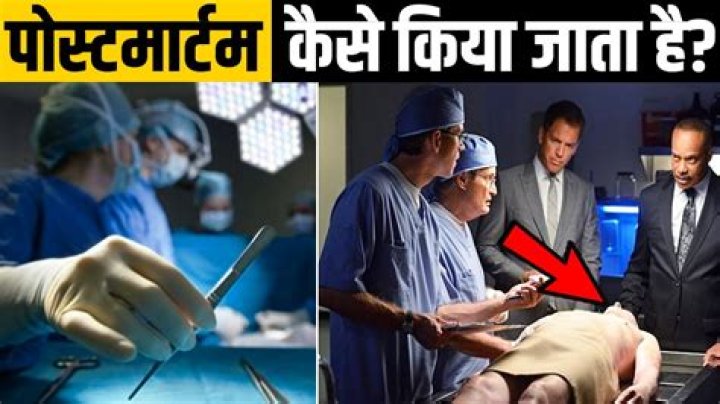 Who can do postmortem in India?