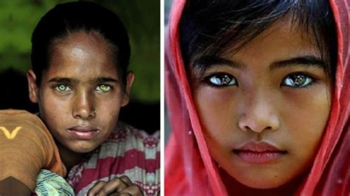 Who most beautiful eyes?