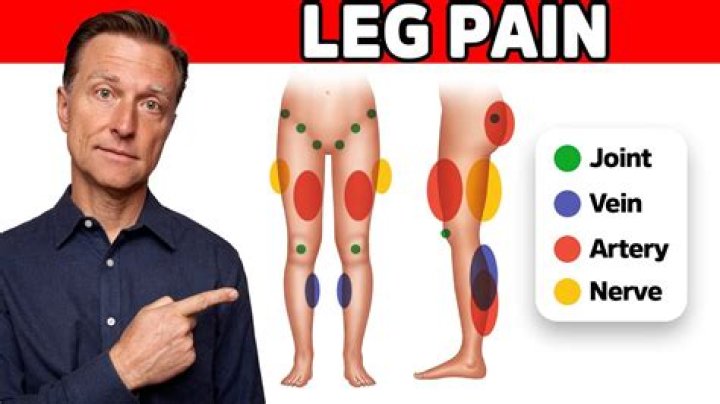 Why are my legs sore for days?
