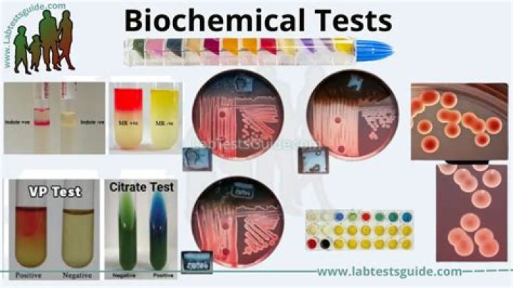 Why are the biochemical Analyses performed?