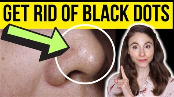 Why do I have black stuff coming out of my nose?