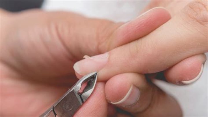 Why do I keep getting so many hangnails?