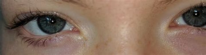 Why do my eyes look soulless?