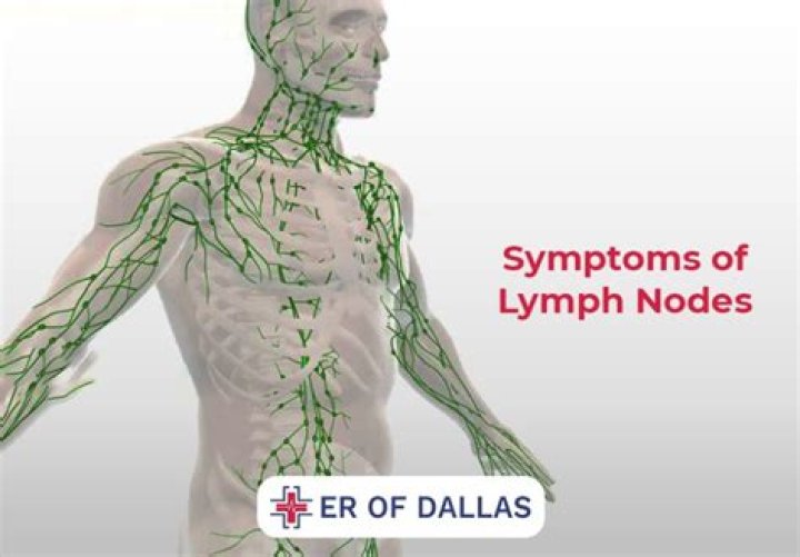 Why do my lymph nodes hurt on one side?