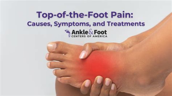 Why do my shoes hurt the top of my feet?
