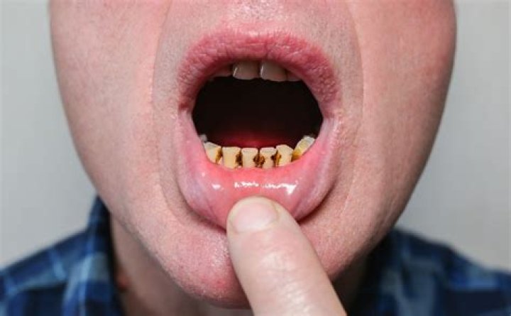 Why do my teeth throb after brushing?