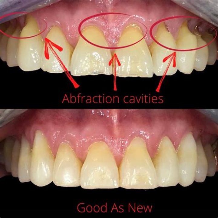 Why does it feel like there is something in my teeth?