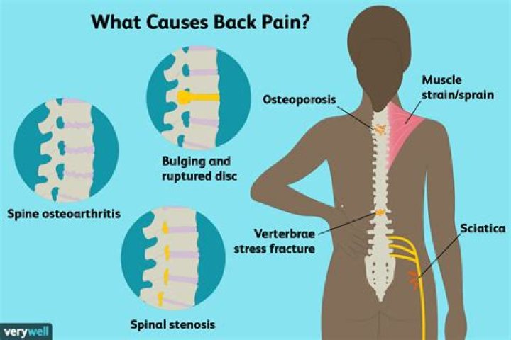 Why does my back hurt when I turn my neck?