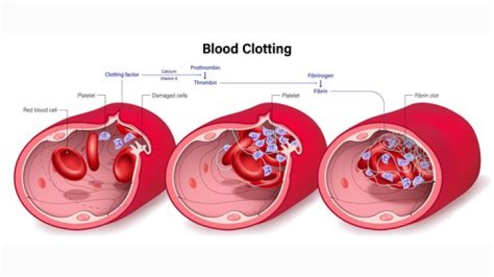 Why does my blood take longer to clot?