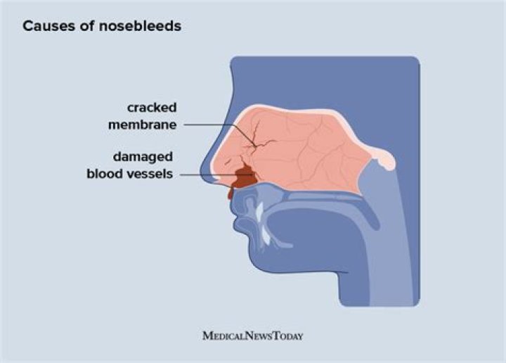 Why does the skin on my nose bleed?