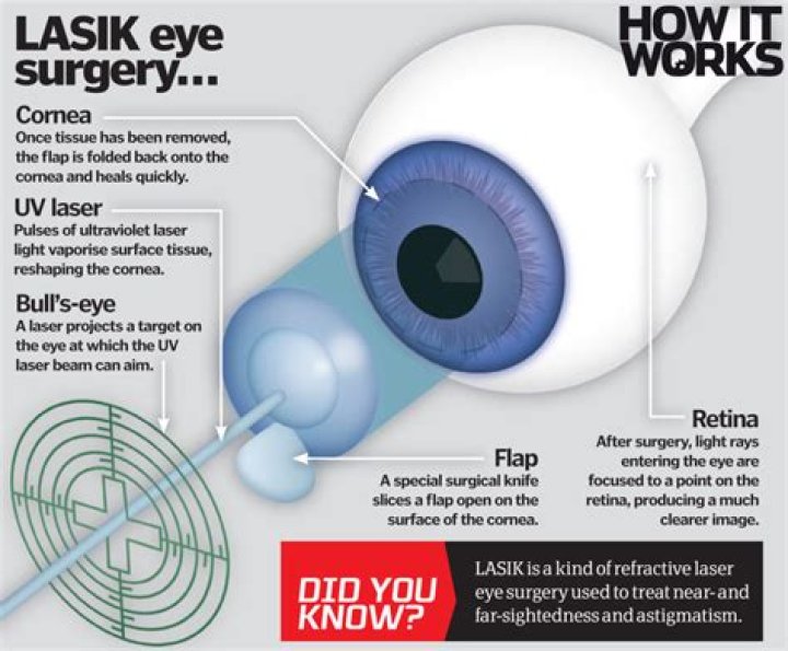 Why is krypton used in laser eye surgery?
