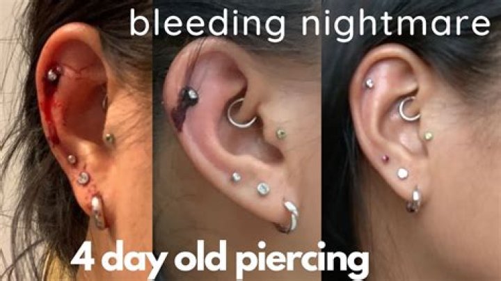 Why is my piercing still bleeding?