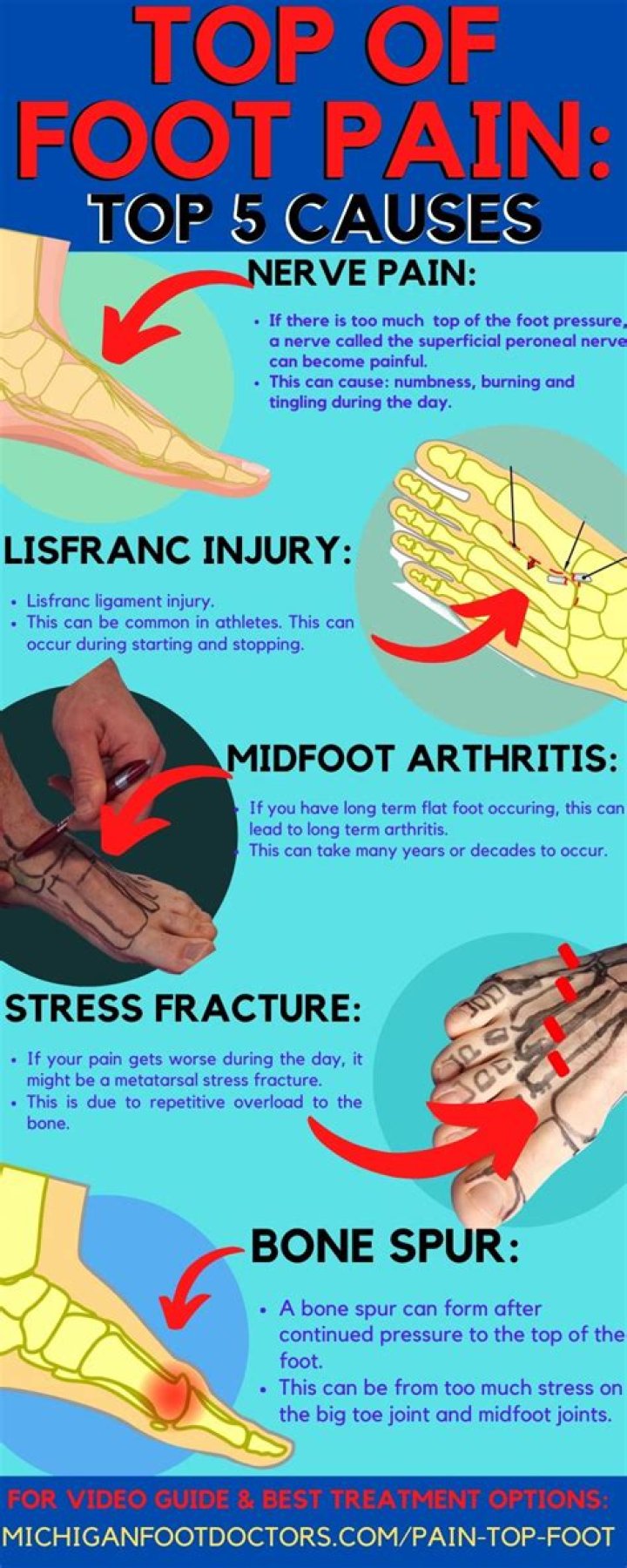 Why is the top of my foot swollen and painful?