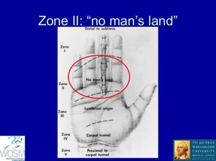 Why is Zone 2 No Man's Land?