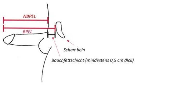 Wie alt werden Inder im Durchschnitt?