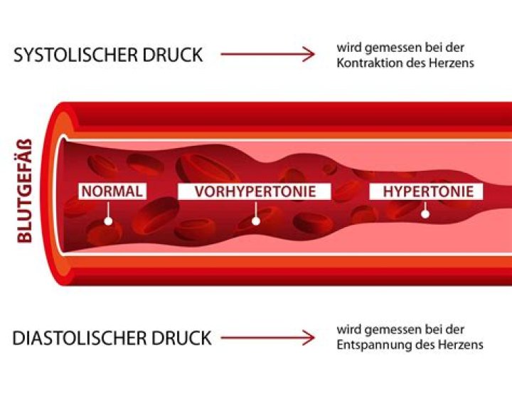 Wie hoch darf der systolische Wert sein?