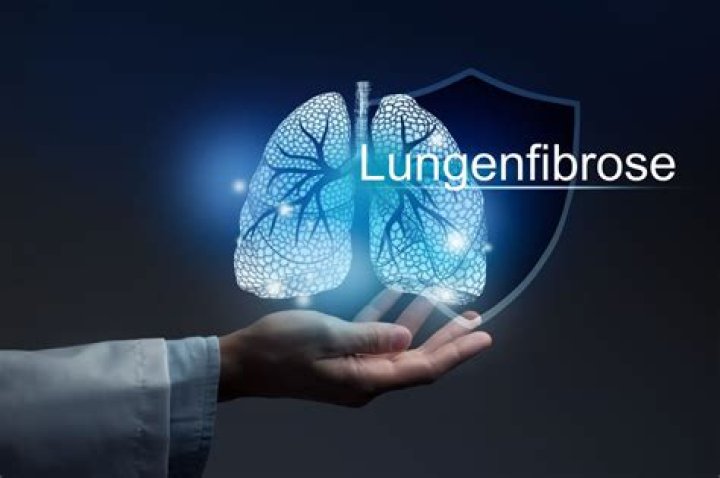 Wie lange kann man mit einer Lungenfibrose leben?