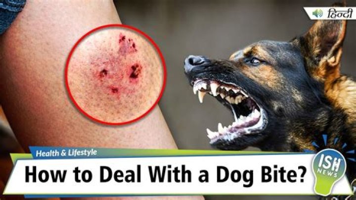 Will dogs bite if they sense fear?