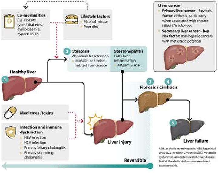 Will liver enzymes be elevated with pancreatitis?