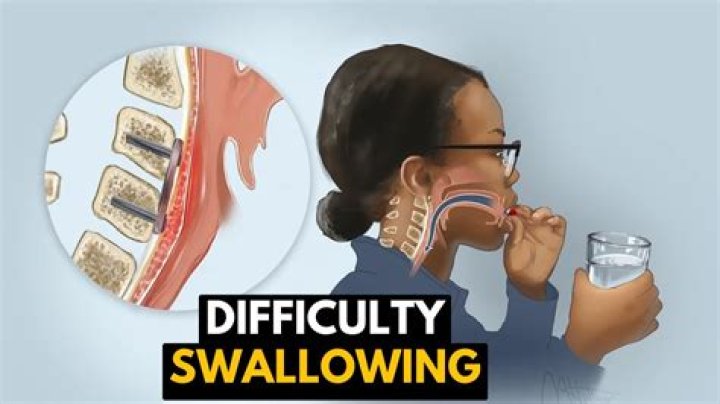 Will swallowing a fly hurt you?