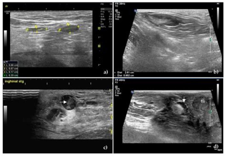 Will ultrasound show cancer in dogs?